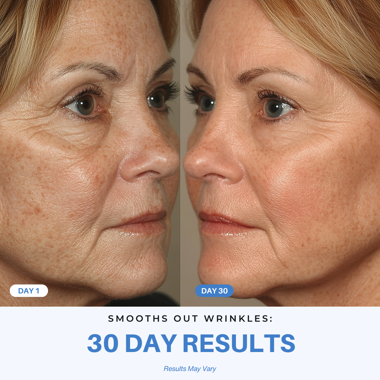 iAura Smooths Out Wrinkles30 Day Results